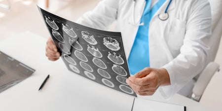 Acquired brain injury (ABI)