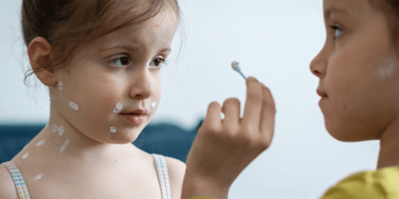 Chickenpox and shingles