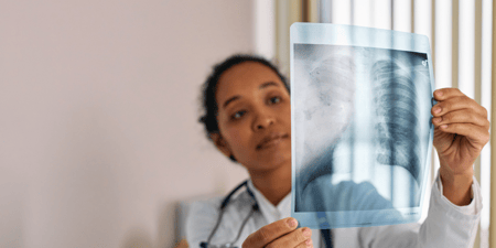 Chronic obstructive pulmonary disease (COPD)