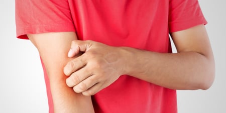 Eczema and psoriasis