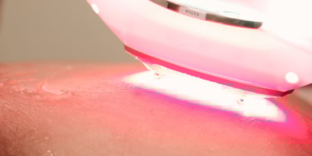 Photobiomodulation Therapy (PBM)