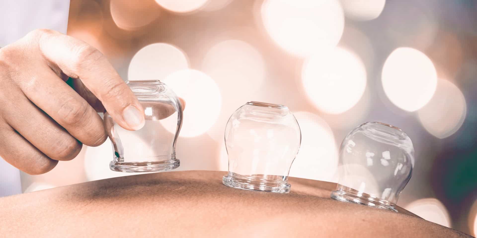 Cupping